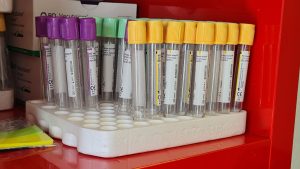 Medicīniskās testa mēģenes laboratorijas analīzēm.