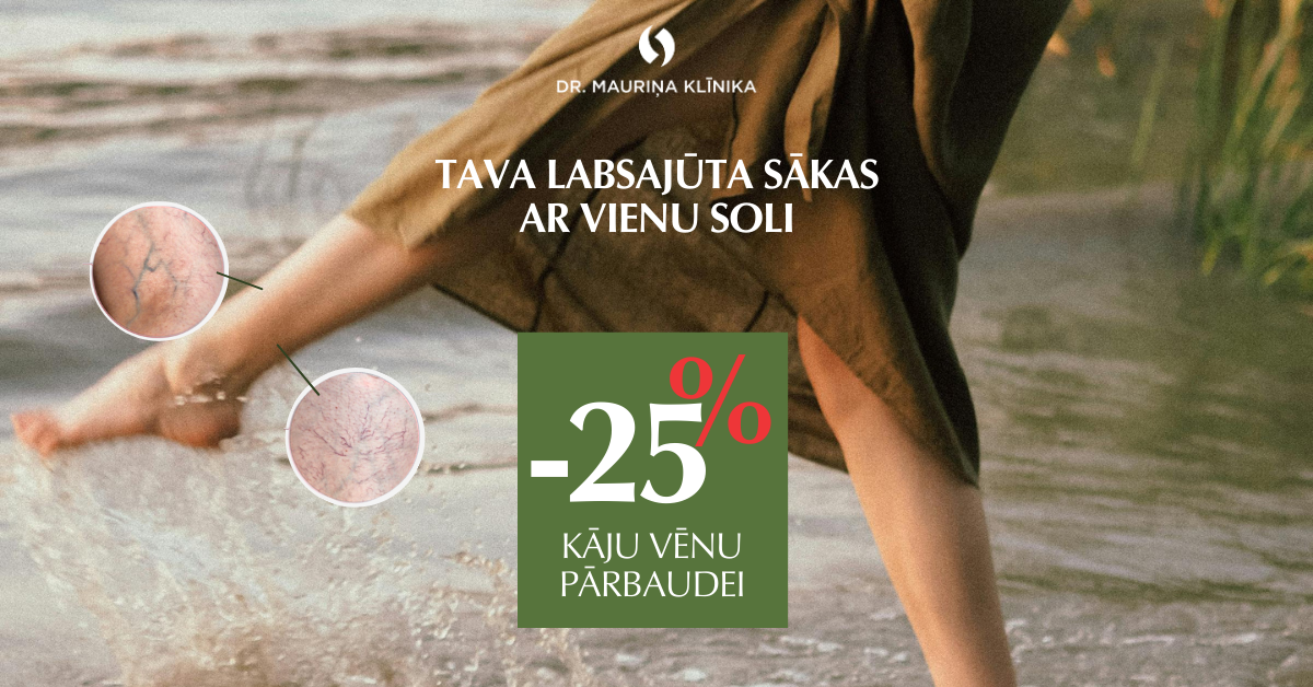 Sievietes kājas ūdenī ar norādēm uz vēnu problēmām un informāciju par 25% atlaidi kāju vēnu pārbaudei Dr. Mauriņa klīnikā.
