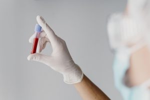 Mediķis ar cimdiem tur testa mēģeni ar asiņu paraugu
