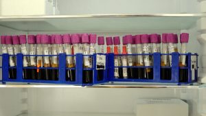 Asins paraugu mēģenes laboratorijā