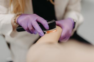 Ārsts ar violetiem cimdiem veic ādas procedūru uz pacienta rokas